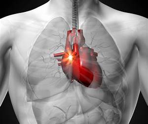 A Heart in Trouble A Heart in Trouble