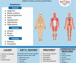 A Simple Guide to Addison's Disease, Treatment and Related Conditions (A Simple Guide to Medical Conditions)