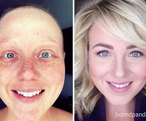Before and After Cancer Treatment (A Johns Hopkins Press Health Book)
