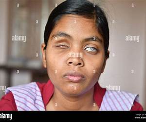 Blind Girl Blind Girl