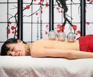 Chinese Cupping Healing Therapy Chinese Cupping Healing Therapy
