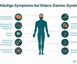 Das Ehlers-Danlos-Syndrom Das Ehlers-Danlos-Syndrom