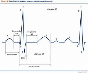 Guia de Eletrocardiograma: Passo-a-passo (MedBook) (Portuguese Edition) Guia de Eletrocardiograma: Passo-a-passo (MedBook) (Portuguese Edition)