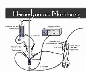 Hemodynamic Monitoring in the ICU Hemodynamic Monitoring in the ICU