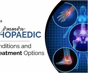 Orthopedic Conditions Orthopedic Conditions
