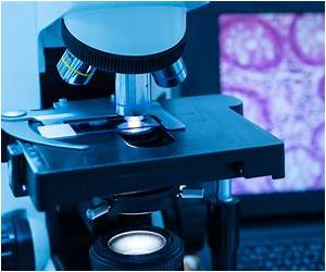 Pathology: General Pathology: General