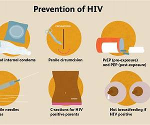 Sexually Transmitted Diseases and HIV/AIDS Sexually Transmitted Diseases and HIV/AIDS