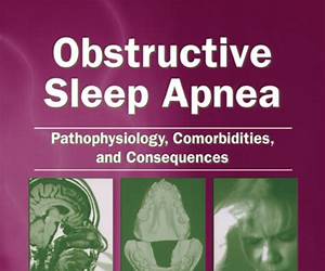 Sleep Apnea Book: Secrets of Sleep Apnea Treatment, Cure, Exercises, Machine and Pillow Advice (Sleep Apnea, Sleep Apnea Books, Sleep Apnea Cure, Sleep ... Sleep Apnea Machine, Sleep Secre) Sleep Apnea Book: Secrets of Sleep Apnea Treatment, Cure, Exercises, Machine and Pillow Advice (Sleep Apnea, Sleep Apnea Books, Sleep Apnea Cure, Sleep ... Sleep Apnea Machine, Sleep Secre)