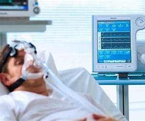 Ventilator Management: An Oakes Pocket Guide
