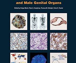 WHO Classification of Tumours of the Urinary System and Male Genital Organs [OP]